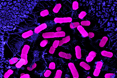 Fluorescent pink, rod-shaped Escherichia coli bacteria.