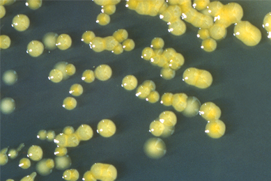 Yolk-like spheres of Enterobacter sakazakii bacteria.
