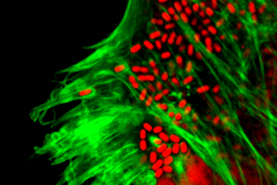 Red, rod-shaped Shigella bacteria in a green web.