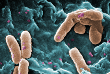 Brown, rod-shaped Pseudomonas aeruginosa bacteria.