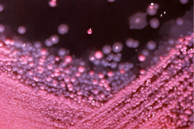 Tiny beads of pink and purple bacteria in MacConkey growth medium.
