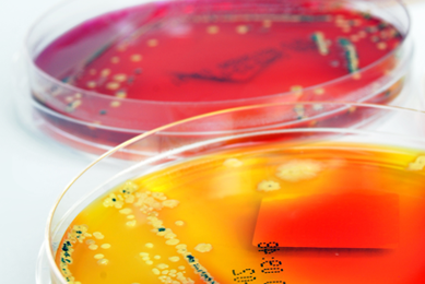 Petri dishes containing bacteria colonies on red and orange media.