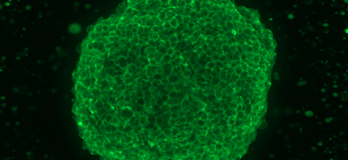 A bright-green, fluorescent, EGFR stain sphere with a black background.