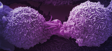 Round, textured, purple lung cancer cells on a dark background. 