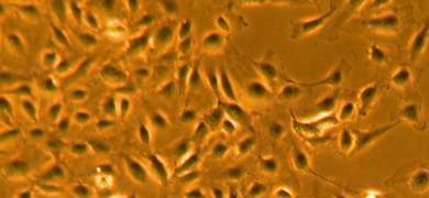 Orange and black dermal microvascular endothelial cells.