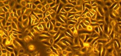 Small, yellow, orange and black primary keratinocyte cells.