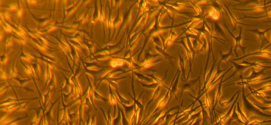 Small, long, thin, yellow and brown melanocyte cells.