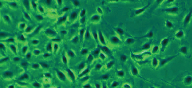 Small, lime green and black  microvascula endothlial cells.
