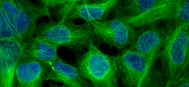 Green and blue beta tubulin cells.