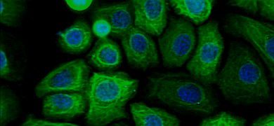Small, fluorescent green and blue, spherical lung cells.