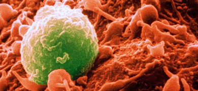 Green and orange lymphocyte spheres.