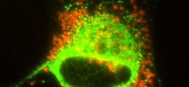 fluorescent yellow-green and orange schwann cells.