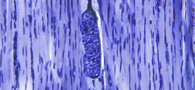 Blue skeletal striated muscle tissue cells.