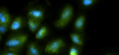 Faded, fluorescent blue and green exosome cells.