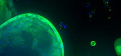 Green and blue organoid cells.