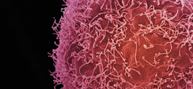 Pink skin cancer cells.