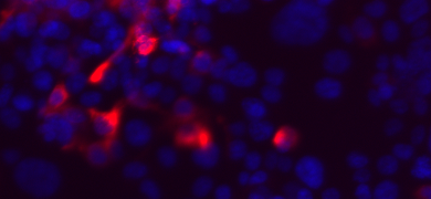 Fluorescent blue and red colon cells.