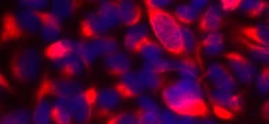 Fluorescent blue-purple, and red, lung, epithelial mesenchymal transition reporter cells.