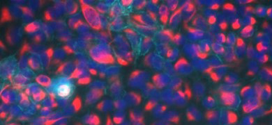 Fluorescent blue, purple, and red, lung, epithelial mesenchymal transition reporter cells.