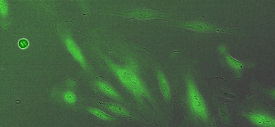 Green MEC phase microvascular endothelial cell.