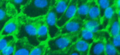 Fluorescent lime green and blue web of  renal proximal tubular epithelial cells.