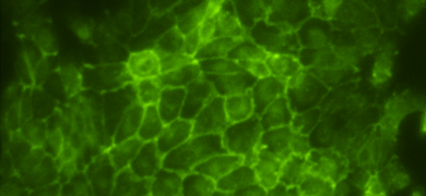 Web-like, fluorescent green renal proximal tubular epithelial cells.