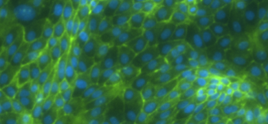 Web-like, fluorescent green and blue renal proximal tubular epithelial cells.