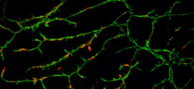 Green and red human aortic endothelial cells.