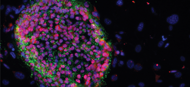 Human Induced Pluripotent Stem Cells | ATCC