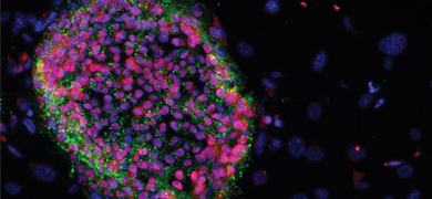Purple and green merged induced pluripotent stem cells.