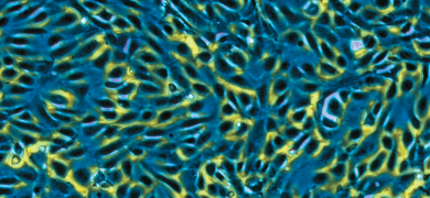Small, rod-shaped, fluorscent blue and yellow  human umbilical vein endothelial cells.
