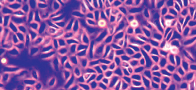 Small, rod-shaped, fluorscent pink keratinocyte cells.