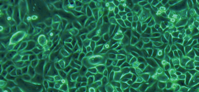 Small, spherical, fluorescent green prostate cells.