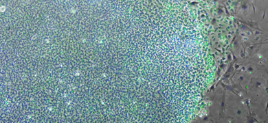Blue and gray embryonic induced pluripotent stem cells.