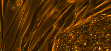 Long, fluorescent orange and brown embryonic stem cells.