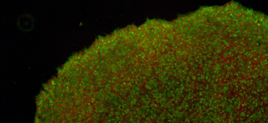Green and orange induced pluripotent stem hepatic fibroblast cells.