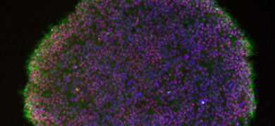 Human Induced Pluripotent Stem Cells | ATCC