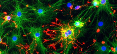Astrocytes and oligodendrocytes from neural stem cells.