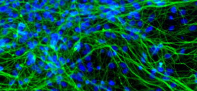 Neurons derived from human neural stem cells.