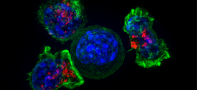 Spherical orbs of fluorescent green, blue, and red killer T cells.