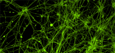 Green neural progenitor stem cells.