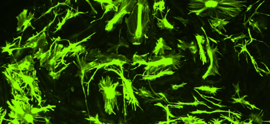 Green astrocyte neural progenitor cells.