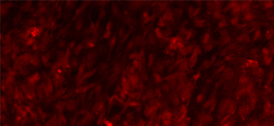 Red Parkinsons cells.