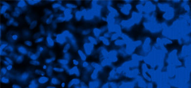 Blue neural progenitor DAPI Parkinsons cells.
