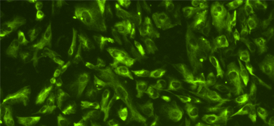 Green ICC Nestin neural progenitor cells.