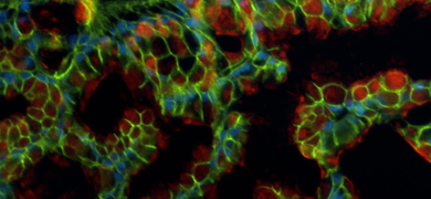 Green and red african american male IPS cells.