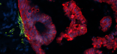 Red and blue organoid cells.