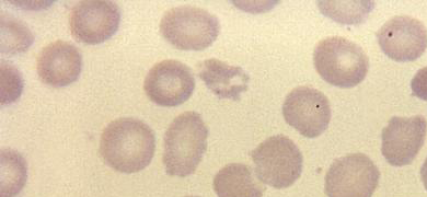 Grainy, round, pale pink spheres of Babesia. 