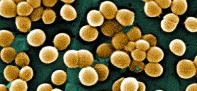 Round, yellow balls of methicillin resistant staphylococcus aureaus.