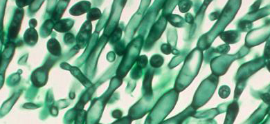 Green, translucent, spherical and rod-shaped Candida albicans fungus.